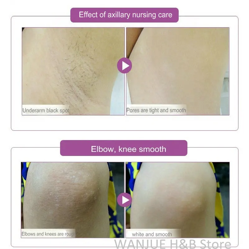 HOT Whitening Cream Body Dark Skin Armpit Knee Lightening Underarm Inner Thigh Hot High Quality Body Cream skin care 50G
HOT Whitening Cream Body Dark Skin Armpit Knee Lightening Underarm Inner Thigh Hot High Quality Body Cream skin care 50G