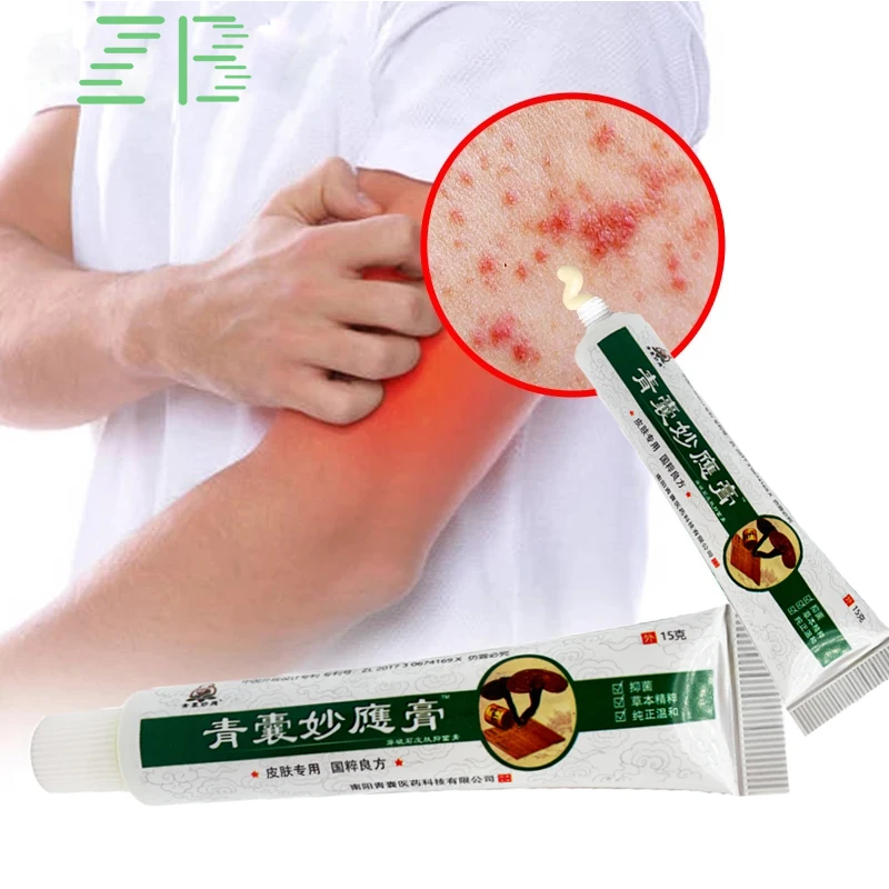 

ZB 15 г Китайский крем от псориаза дерматит экзема мазь противогрибковая избавляет кожу от зуда Beriberi сыпь аллергия укусы комаров