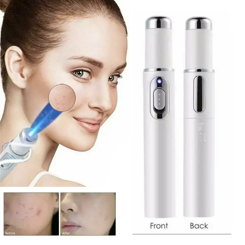 Heath Blue Light Therapy Varicose Veins Treatment Laser Pen Soft Scar Wrinkle Removal Treatment Acne Laser Pen Massage Relax
Heath Blue Light Therapy Varicose Veins Treatment Laser Pen Soft Scar Wrinkle Removal Treatment Acne Laser Pen Massage Relax