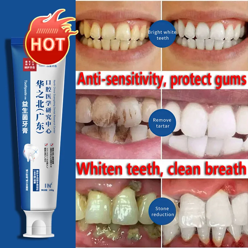 2023 New Type of Rapid Removal of Plaque Toothpaste Whitening Repair Cavities Caries Tartar Solve Yellowing Teeth Gum Care 100g
2023 New Type of Rapid Removal of Plaque Toothpaste Whitening Repair Cavities Caries Tartar Solve Yellowing Teeth Gum Care 100g