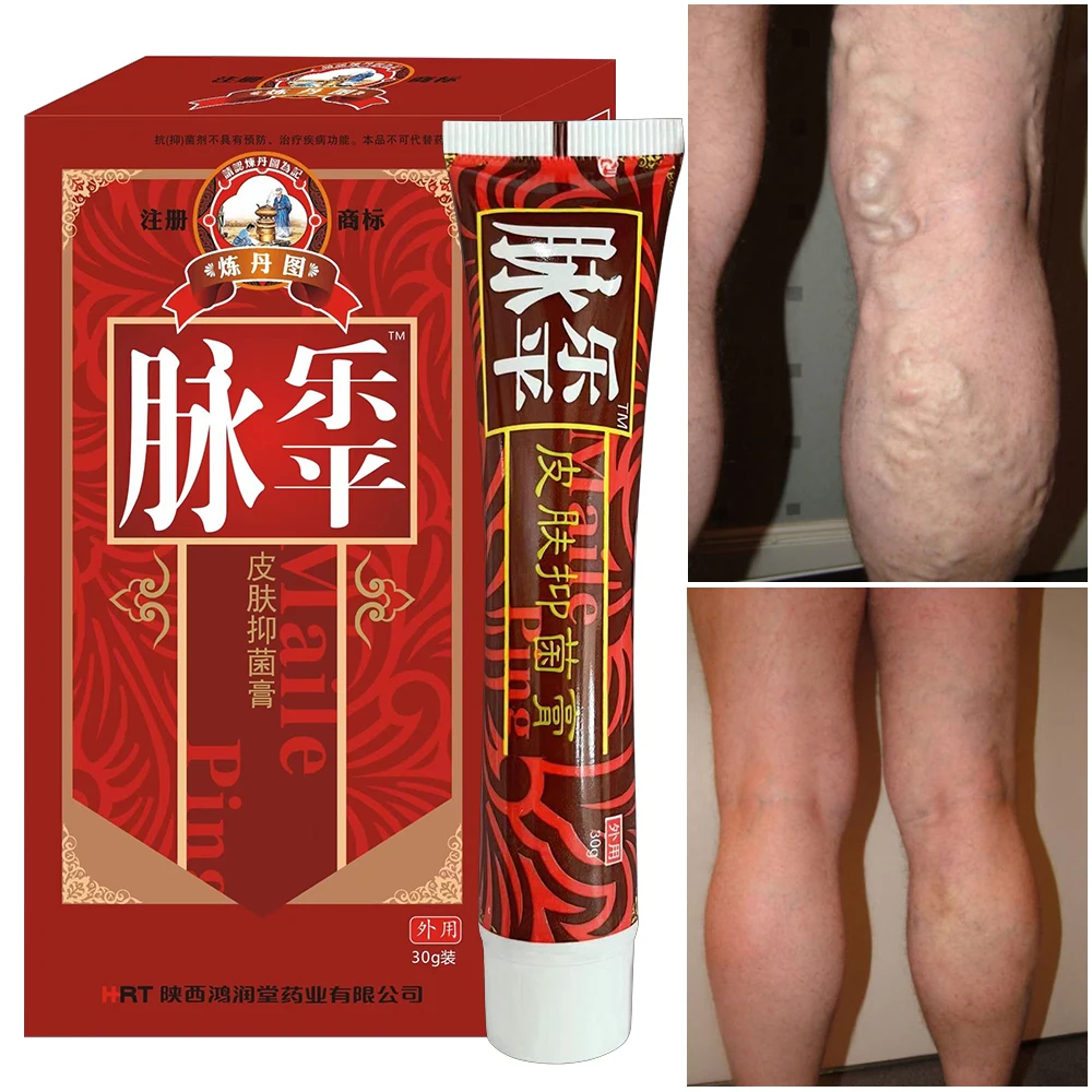 Varicose Veins Relief Cream Vasculitis Phlebitis Spider Pain Relief Ointment Medical Plaster Body Care Intravenous Ointment30g
Varicose Veins Relief Cream Vasculitis Phlebitis Spider Pain Relief Ointment Medical Plaster Body Care Intravenous Ointment30g