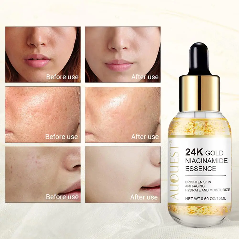 Niacinamide Serum Hyaluronic Acid for Face Dark Spot Remover 24K Gold Serum Whitening Moisturizing Facial Skin Care 15ml W1L6
Niacinamide Serum Hyaluronic Acid for Face Dark Spot Remover 24K Gold Serum Whitening Moisturizing Facial Skin Care 15ml W1L6