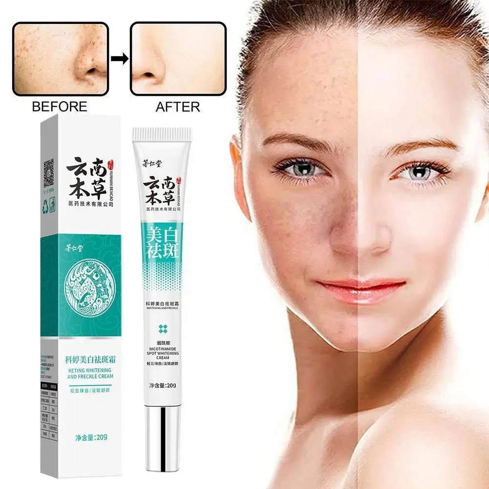 

Freckle-Removing White Spot Cream For Face Lighten Dark Spot Corrector Whitening Skin Cream Remove Acne For Beauty J5T9