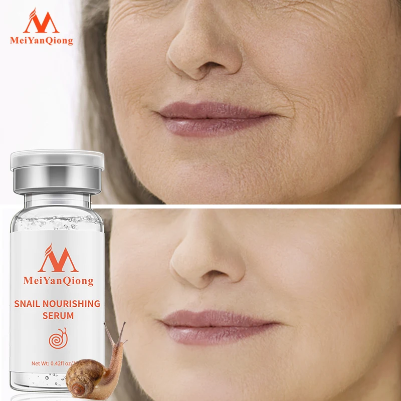MeiYanQiong Natural Pure Snail Essence Liquid Hyaluronic Acid Whitening Spot Snail Essence Acne Rejuvenation Essence Skin Care
MeiYanQiong Natural Pure Snail Essence Liquid Hyaluronic Acid Whitening Spot Snail Essence Acne Rejuvenation Essence Skin Care