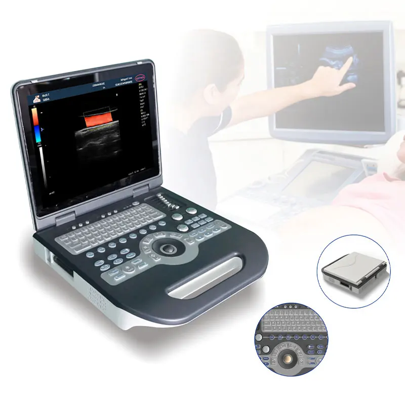 S3800 ultrasound machine portable prices of ultrasound machine mindray ultrasound machine
S3800 ultrasound machine portable prices of ultrasound machine mindray ultrasound machine