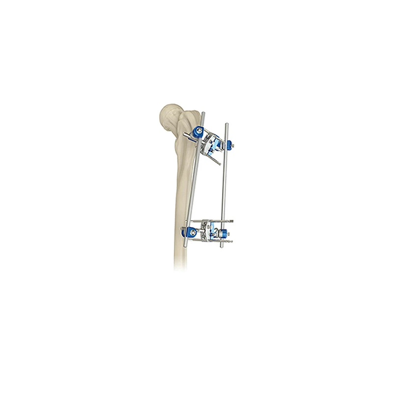 orthopaedic Proximal femur fixator belong to fixation and external fixation
orthopaedic Proximal femur fixator belong to fixation and external fixation