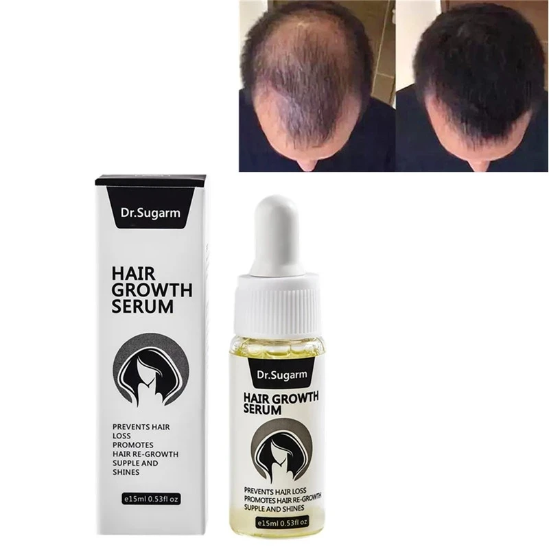 1PC/3PCS/5PCS 15ml Hair Growth Liquid Anti Hair Loss Care Serum Dry Damage Hair Care Treatment Chinese Herb Nourish Scalp Repair
1PC/3PCS/5PCS 15ml Hair Growth Liquid Anti Hair Loss Care Serum Dry Damage Hair Care Treatment Chinese Herb Nourish Scalp Repair