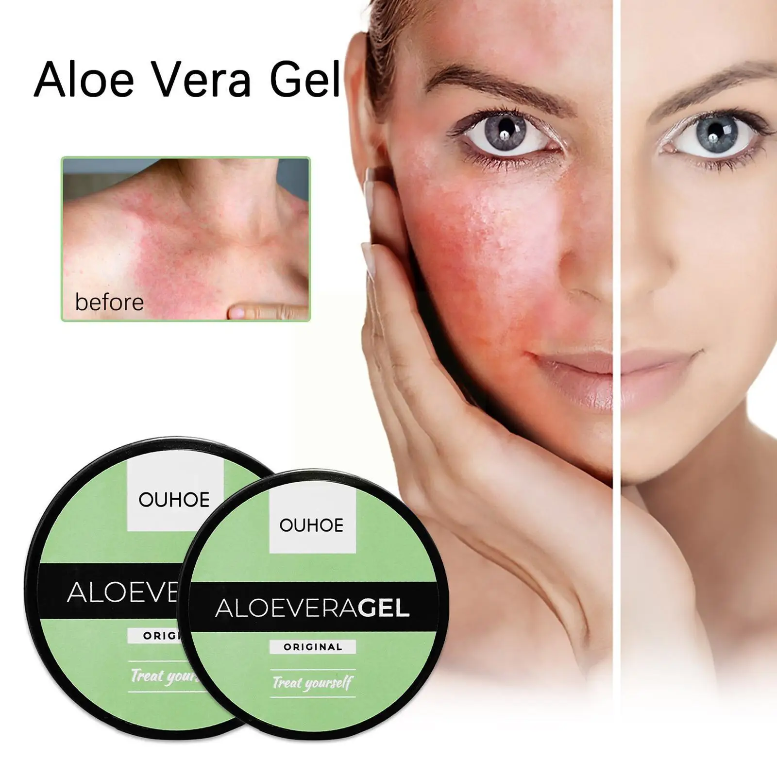 50g Aloe Vera Gel Skin Care Supplementary Nutrition After Pore Moisturizing Dilute Acne Skin Fine Beaut Repair The Whitenin Q3E3
50g Aloe Vera Gel Skin Care Supplementary Nutrition After Pore Moisturizing Dilute Acne Skin Fine Beaut Repair The Whitenin Q3E3