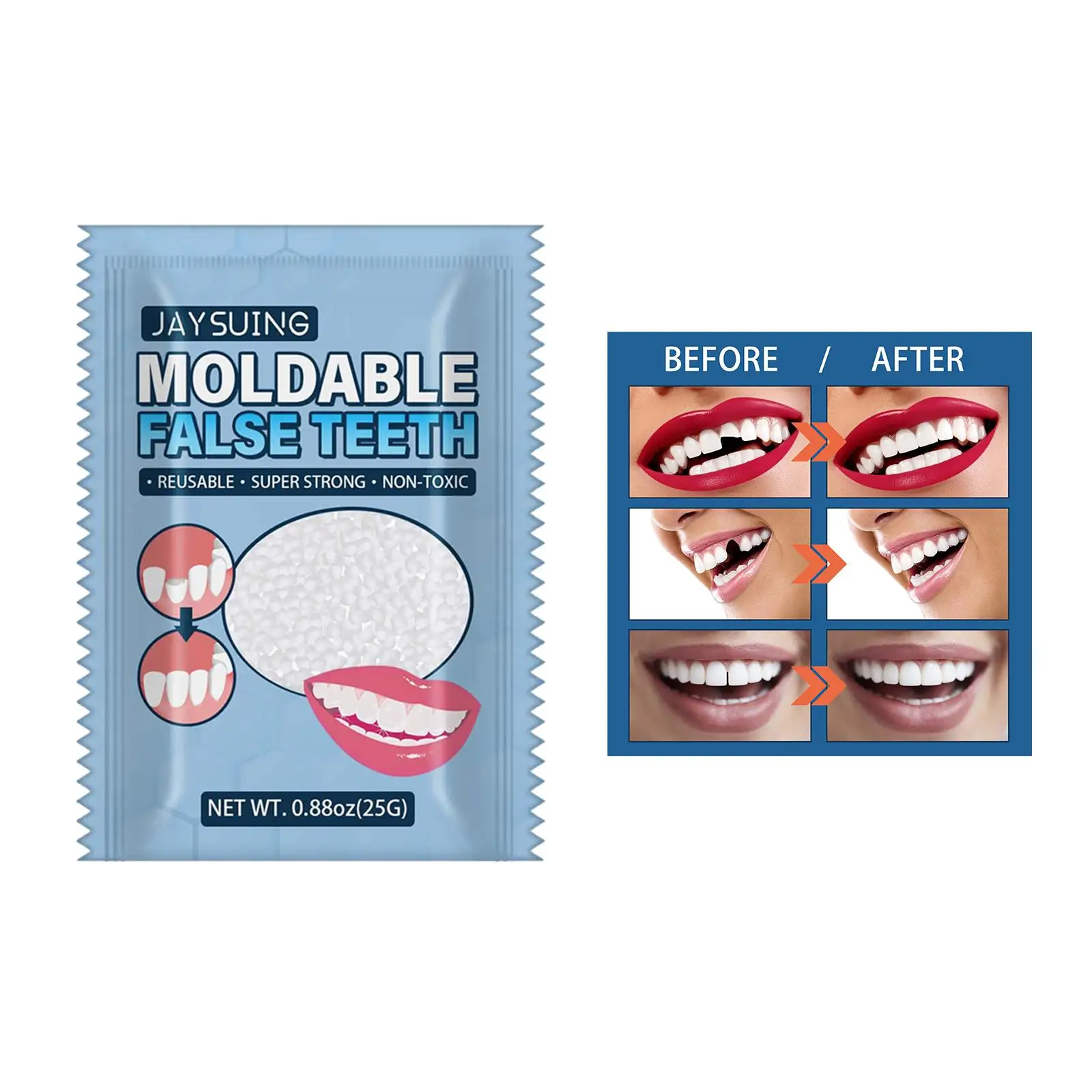 Комплект для временного ремонта зубов 20 г, термальные бусины, молдируемые зубья для нехватки зубов, искусственные зубы, шпон, сломанные неро...
Комплект для временного ремонта зубов 20 г, термальные бусины, молдируемые зубья для нехватки зубов, искусственные зубы, шпон, сломанные неро...