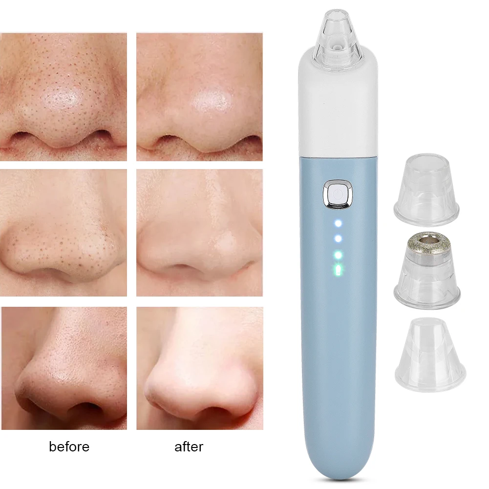 USB Recharging Blackhead Pore Vacuum Cleaner Microcrystalline Pore Cleaning Remove Grease Tighten Skin Blackhead Removal Machine
USB Recharging Blackhead Pore Vacuum Cleaner Microcrystalline Pore Cleaning Remove Grease Tighten Skin Blackhead Removal Machine