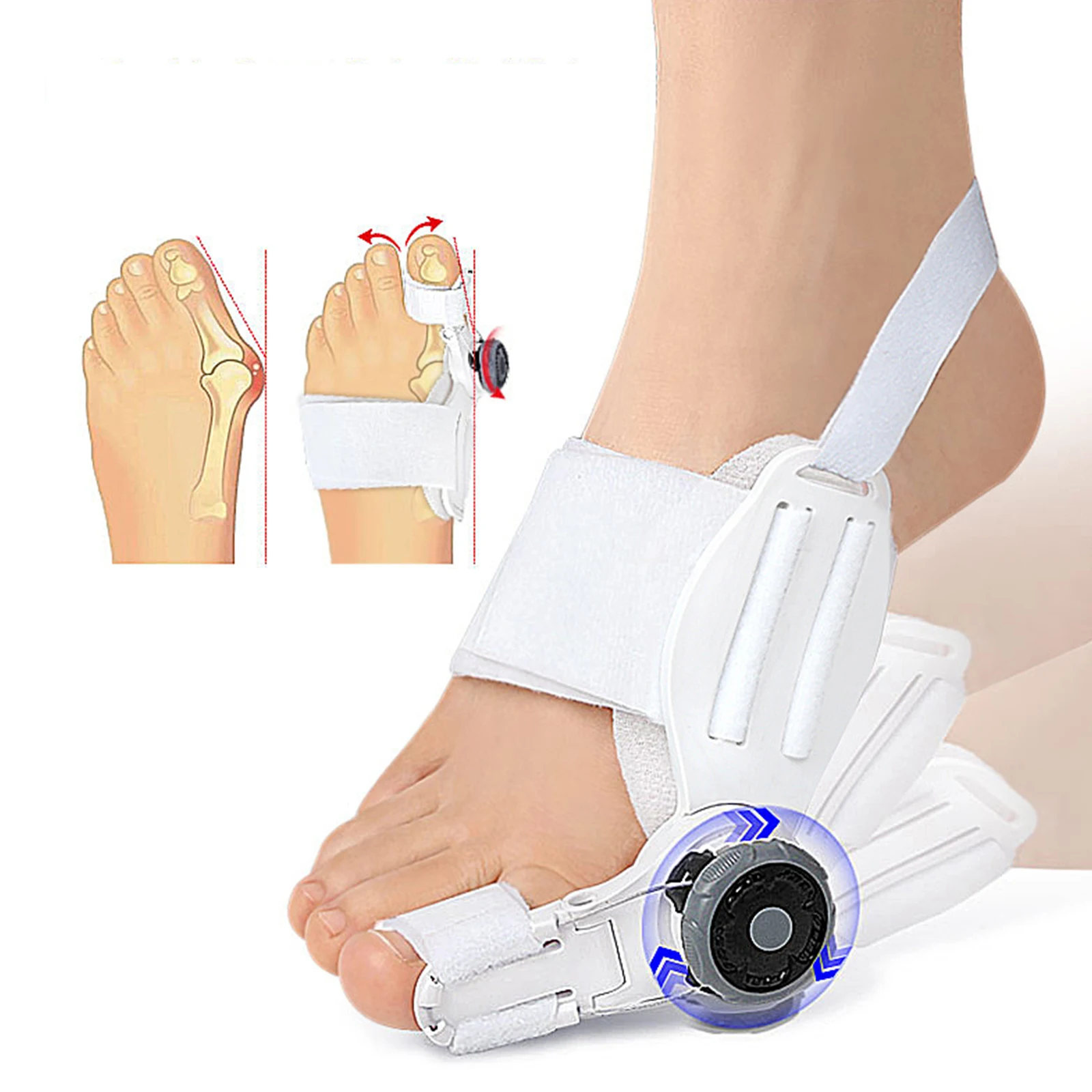 1 шт., корректор большого пальца стопы, ортопедический
1 шт., корректор большого пальца стопы, ортопедический