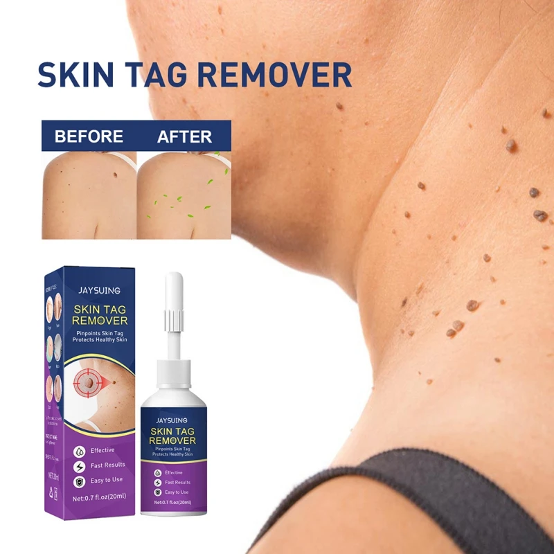 Gram Warts 20ml Makeup Remover Anti-Wart Remedy Liquid Pen Quickly Remove Male And Female Skin Warts Formula Skin Tag Removal
Gram Warts 20ml Makeup Remover Anti-Wart Remedy Liquid Pen Quickly Remove Male And Female Skin Warts Formula Skin Tag Removal