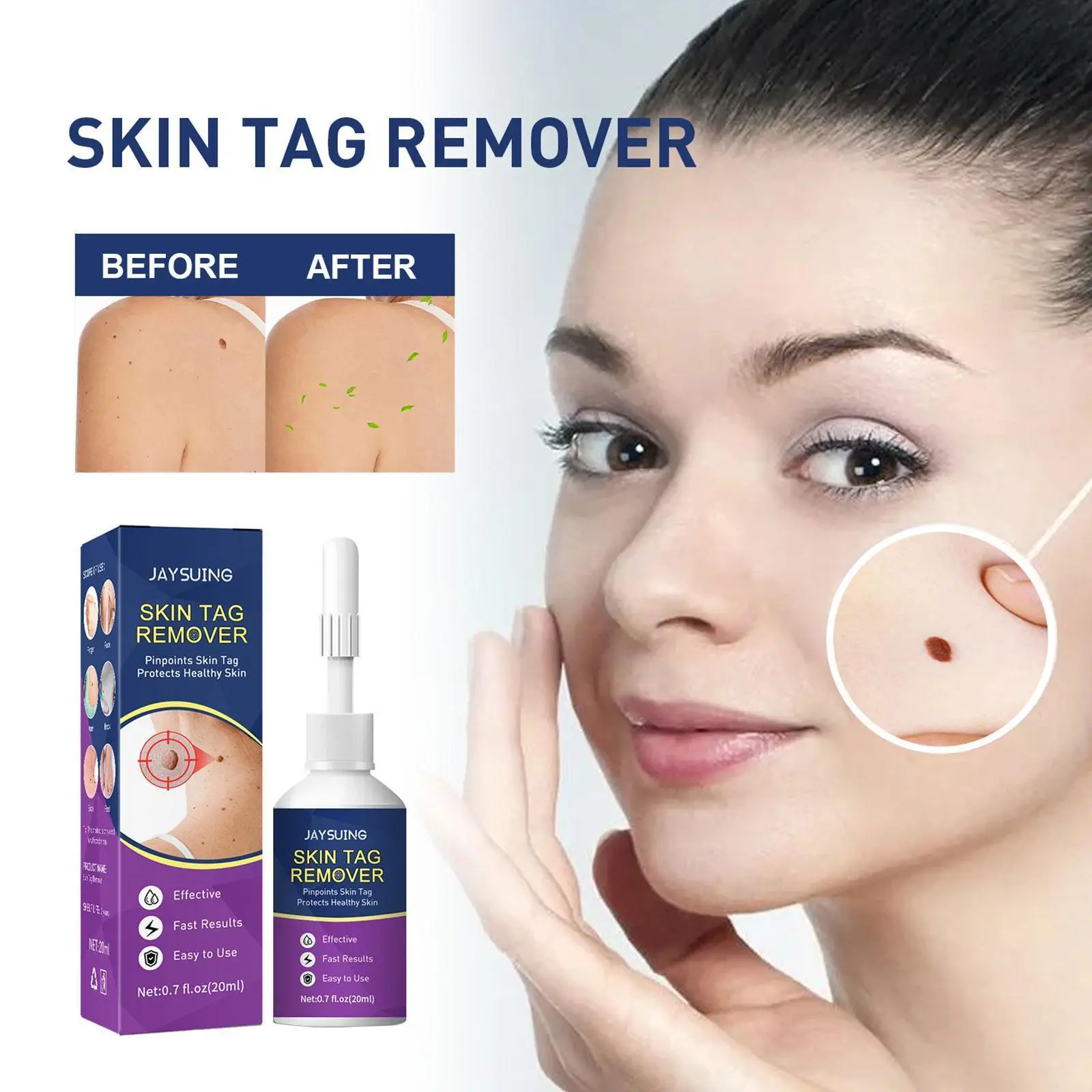 20ml Wart Remover Liquid Remover Dark Spot Wart Removal Body Serum Liquid Neck Tags Wart Cleansing Flesh Face Freckle Treat G7N6
20ml Wart Remover Liquid Remover Dark Spot Wart Removal Body Serum Liquid Neck Tags Wart Cleansing Flesh Face Freckle Treat G7N6