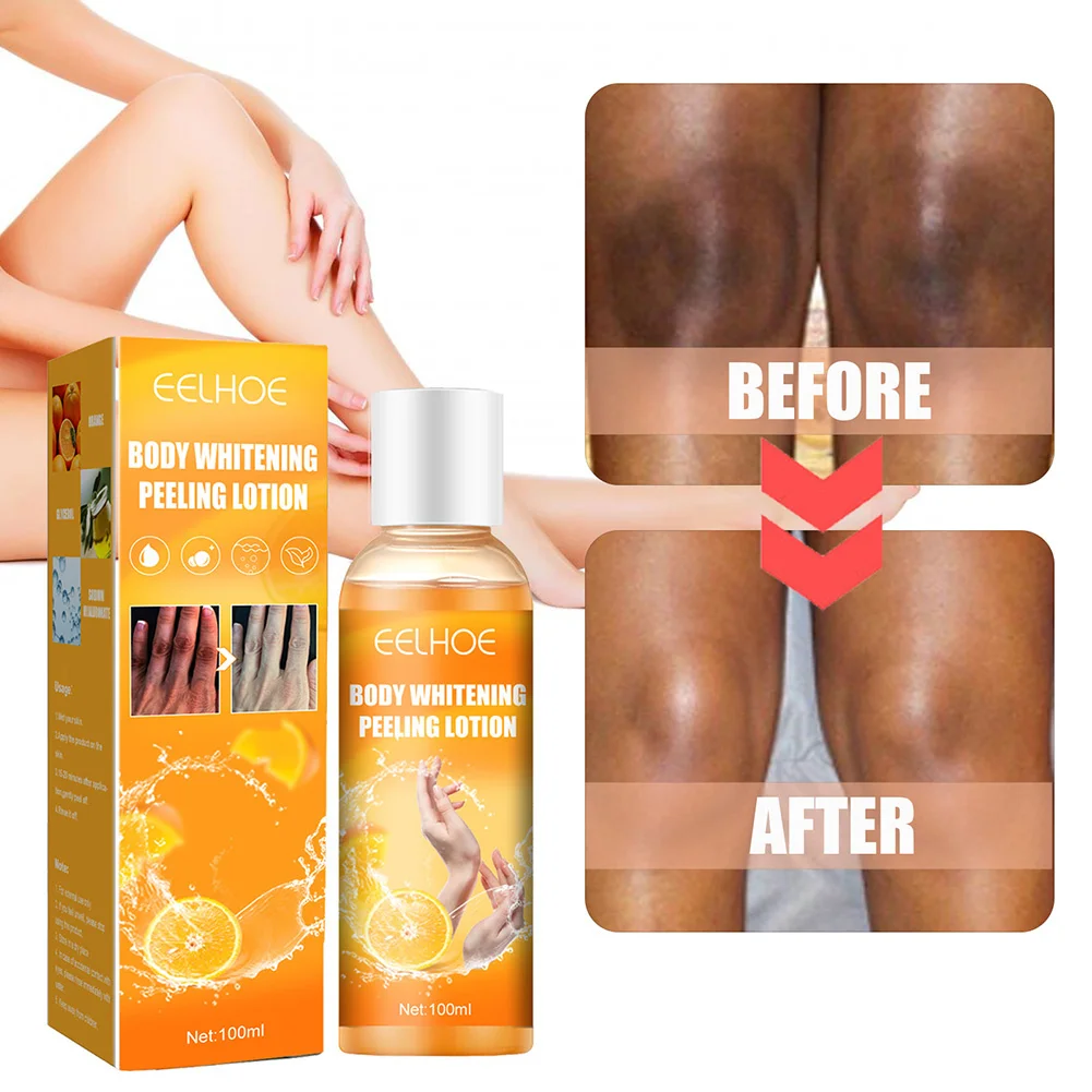 Immediate Whitening Peeling Gel Exfoliating Lotion Knee Armpit Dark Spots Body Brighten Mask Moisturizing Body Skin Care 100ml
Immediate Whitening Peeling Gel Exfoliating Lotion Knee Armpit Dark Spots Body Brighten Mask Moisturizing Body Skin Care 100ml