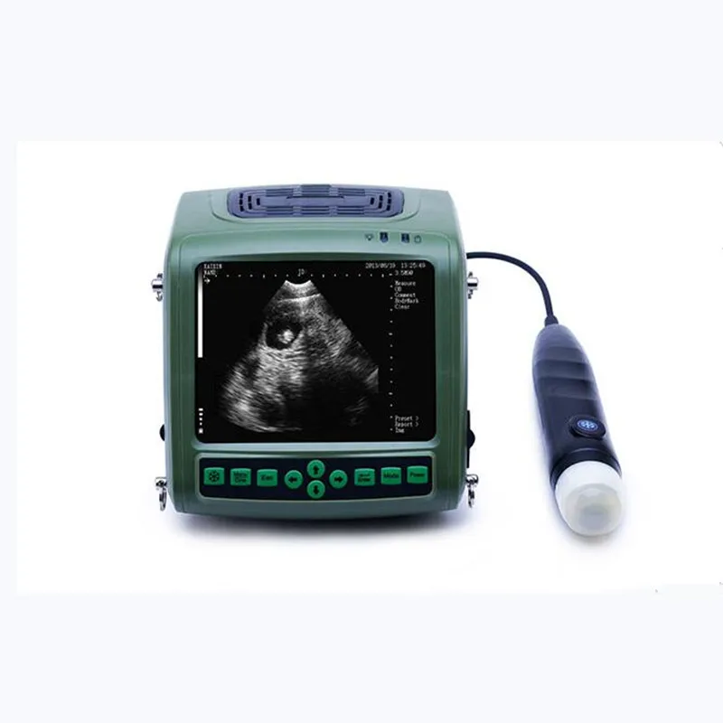 5.7 Inch LCD Portable multifunctional animal pregnancy detector Ultrasound veterinary machine sheep pig pregnancy detector
5.7 Inch LCD Portable multifunctional animal pregnancy detector Ultrasound veterinary machine sheep pig pregnancy detector