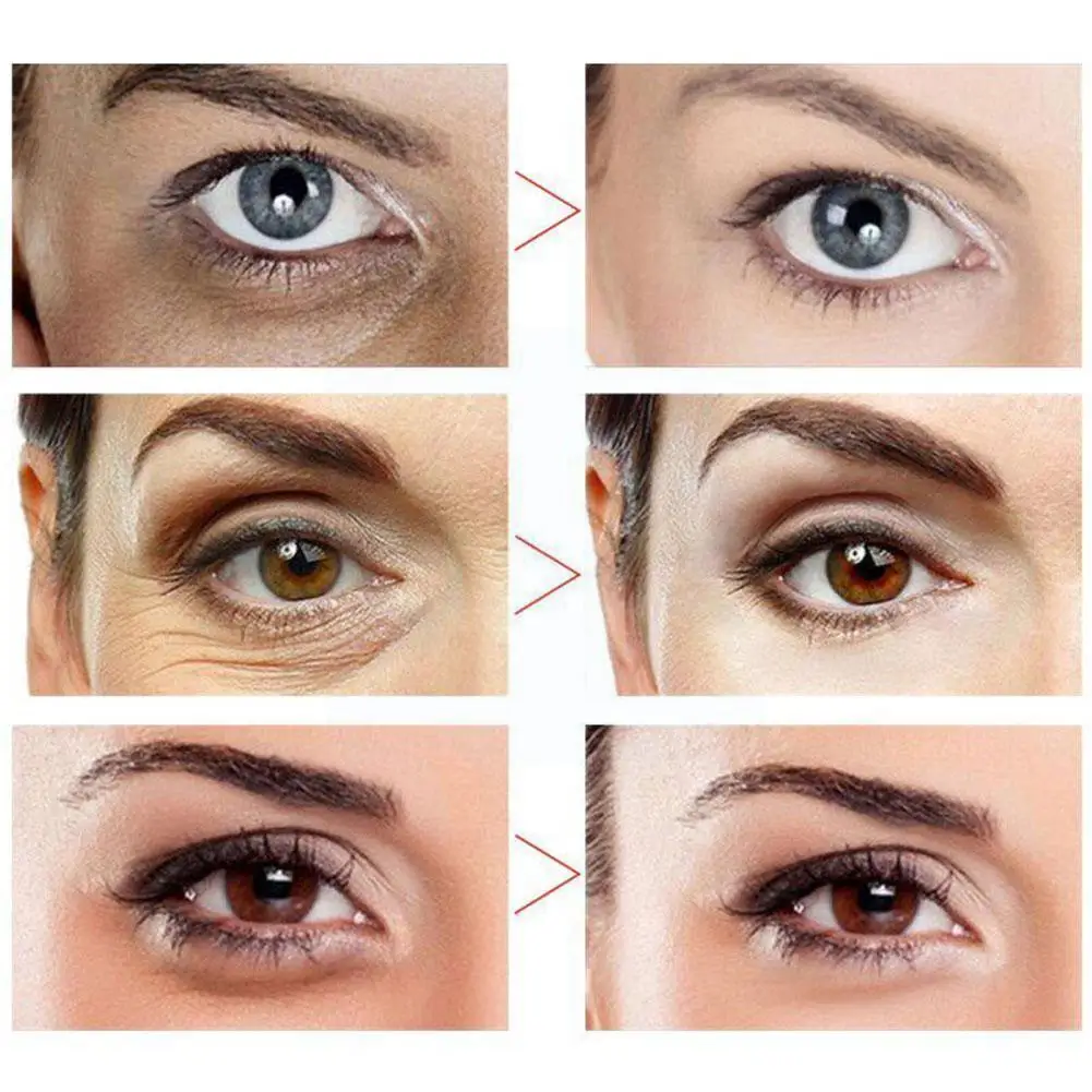 4d Hyaluronic Acid Eye Cream Remove Dark Circle Moisturizing Unisex Anti-puffiness Skin Female Anti-aging Care 60g Male N7o5
4d Hyaluronic Acid Eye Cream Remove Dark Circle Moisturizing Unisex Anti-puffiness Skin Female Anti-aging Care 60g Male N7o5