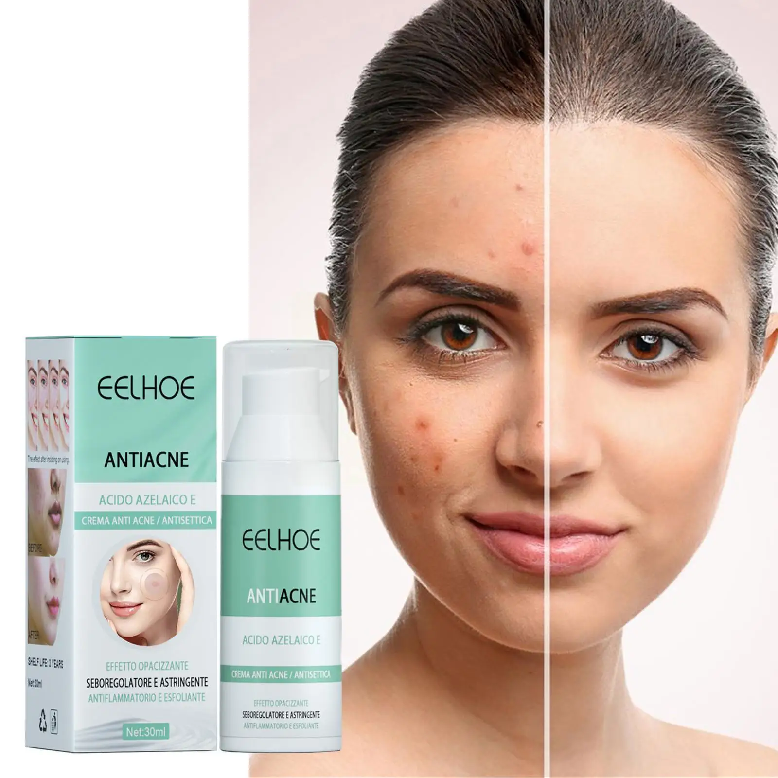 Effective Acne Removal Cream Treatment Acne Scar Shrink Pores Whitening Acne Moisturize Face Skin Oil Care Control S5R9
Effective Acne Removal Cream Treatment Acne Scar Shrink Pores Whitening Acne Moisturize Face Skin Oil Care Control S5R9