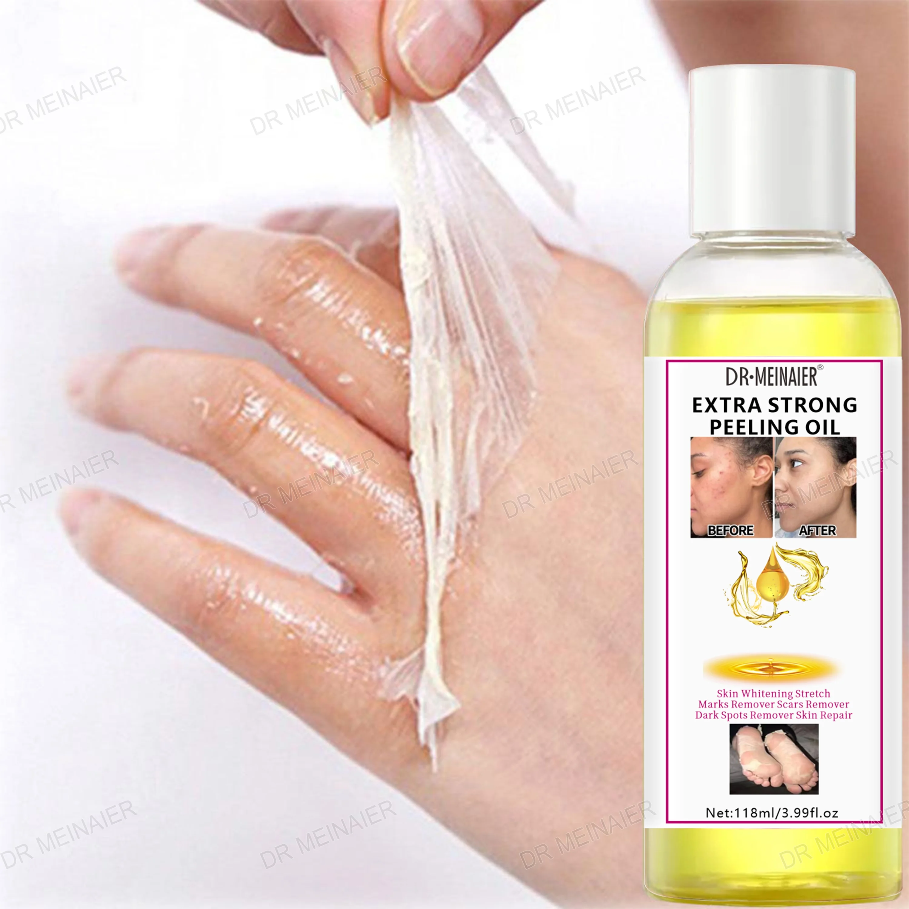 118ml Extra Whitening Skin Peeling Oil Knuckles Remove Dark Spots Exfoliating Dead Skin Anti-aging Face Body Peeling Oil
118ml Extra Whitening Skin Peeling Oil Knuckles Remove Dark Spots Exfoliating Dead Skin Anti-aging Face Body Peeling Oil