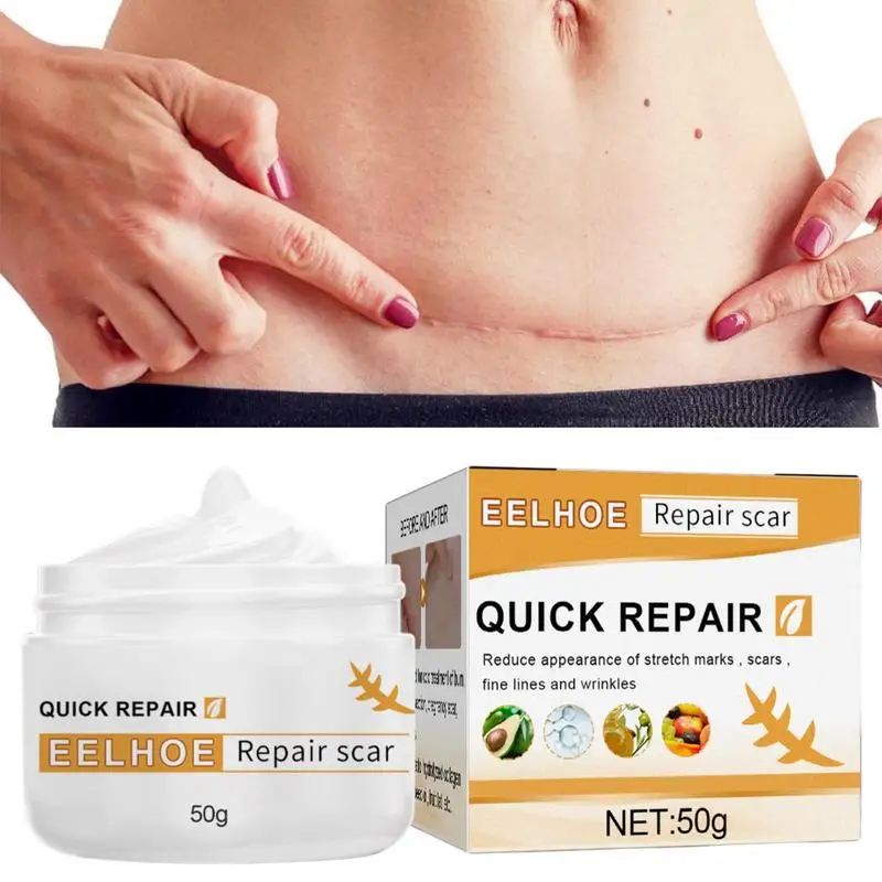 Scar Remover Cream 50g Scar Cream Remover Scar Remover Scar Removal Cream Skin Care Scar Repair Cream For Old New Scars Stretch
Scar Remover Cream 50g Scar Cream Remover Scar Remover Scar Removal Cream Skin Care Scar Repair Cream For Old New Scars Stretch
