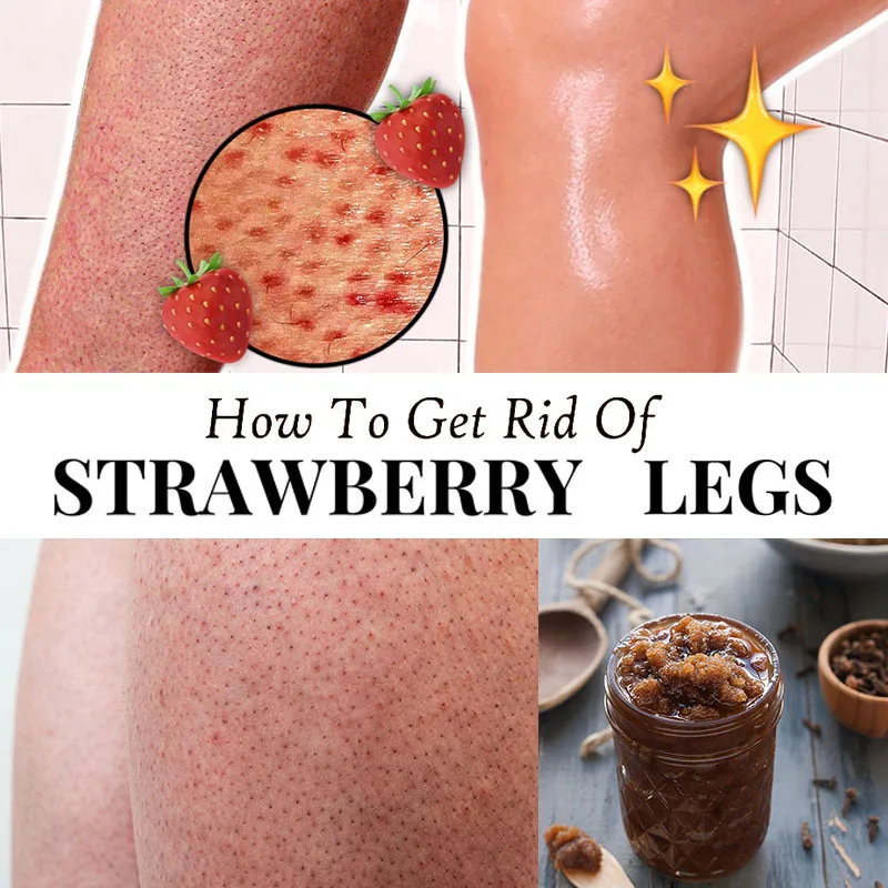 Body Exfoliating Scrubs Get Rid of Strawberry Legs Keratosis Pilaris Removal Foot Exfoliator Pores Cleaning Remove Black Spots
Body Exfoliating Scrubs Get Rid of Strawberry Legs Keratosis Pilaris Removal Foot Exfoliator Pores Cleaning Remove Black Spots
