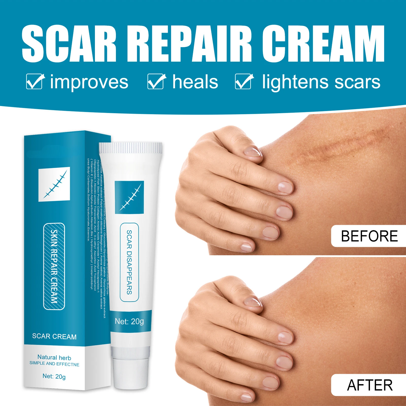 Herbal Scar Removal Cream Gel Stretch Marks Burn Surgical Scars Treatment Smooth Whitening Face Body Skin Care Remove Acne Spots
Herbal Scar Removal Cream Gel Stretch Marks Burn Surgical Scars Treatment Smooth Whitening Face Body Skin Care Remove Acne Spots