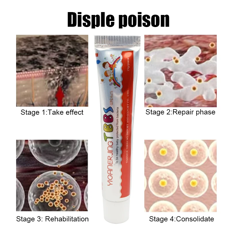 15g Psoriasis Ointment Dermatitis Eczematoid Skin Antibacterial Repair Natural Dressing Eczema Antipruritic Skin Care Cream 
15g Psoriasis Ointment Dermatitis Eczematoid Skin Antibacterial Repair Natural Dressing Eczema Antipruritic Skin Care Cream