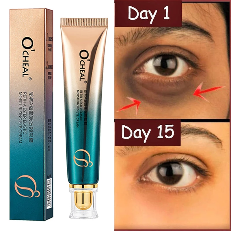 Anti-Wrinkle Eye Cream Fades Fine Lines Anti Dark Circles Eye Serum Remove Eye Bags Puffiness Anti-Aging Firmness Eye Care
Anti-Wrinkle Eye Cream Fades Fine Lines Anti Dark Circles Eye Serum Remove Eye Bags Puffiness Anti-Aging Firmness Eye Care