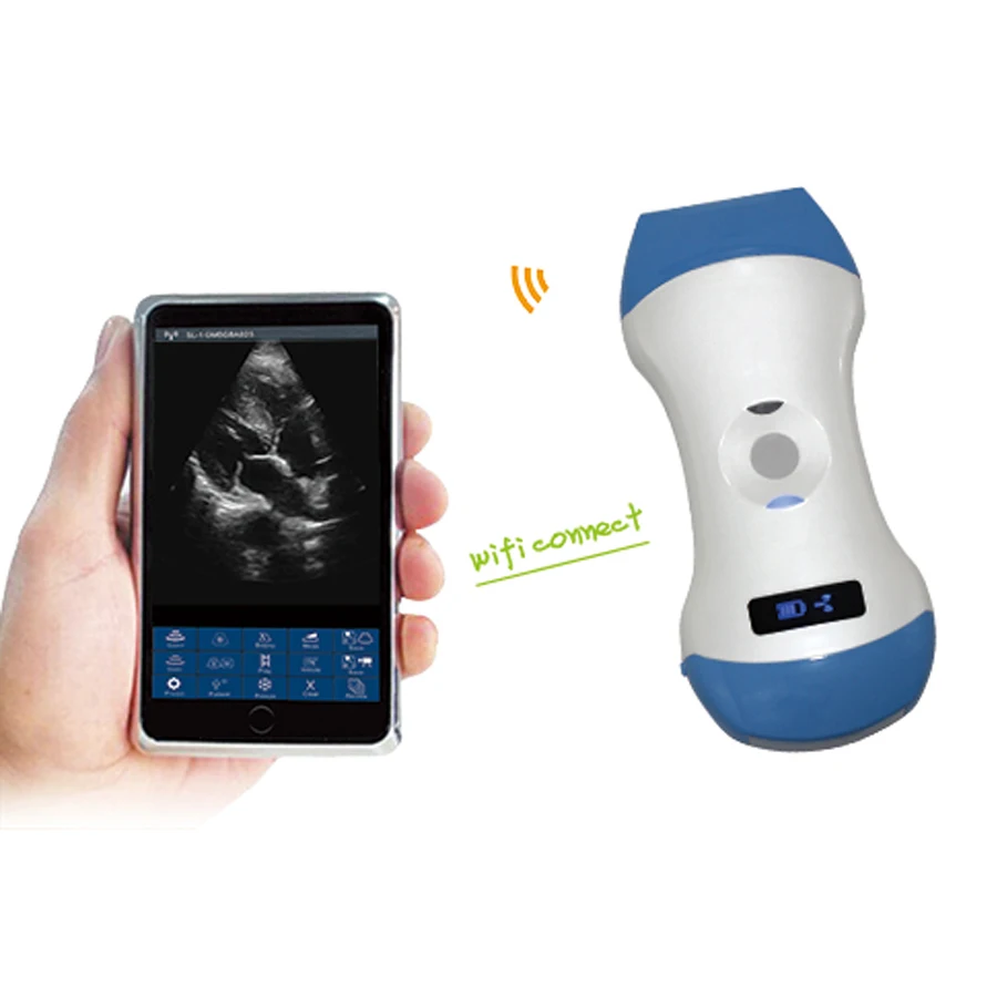 Proper Price 3 in 1 Wireless Cardiac Ultrasound Scanner Machine Convex / Linear / Phased Array probe
Proper Price 3 in 1 Wireless Cardiac Ultrasound Scanner Machine Convex / Linear / Phased Array probe