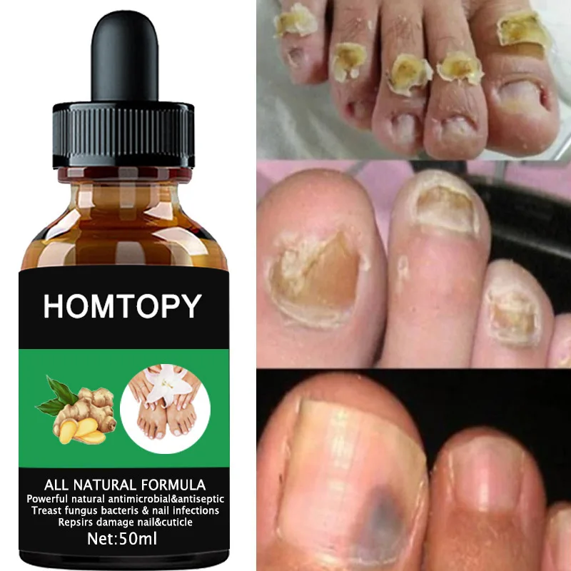 Сыворотка для лечения грибка ногтей 7 дней уход за руками и ногами удаление серых ногтей восстанавливающий гель против инфекции Очищающая э...
Сыворотка для лечения грибка ногтей 7 дней уход за руками и ногами удаление серых ногтей восстанавливающий гель против инфекции Очищающая э...