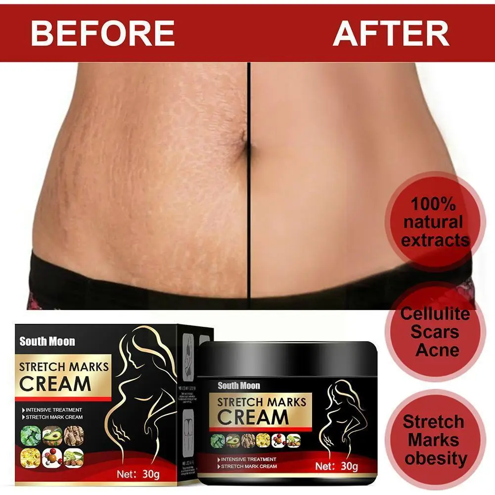 Pregnancy Repair Cream Stretch Mark Removal Removal Scar Treatment Acne Stretch Cream Striae Fat Marks Body Creams Gravidar Z7P6
Pregnancy Repair Cream Stretch Mark Removal Removal Scar Treatment Acne Stretch Cream Striae Fat Marks Body Creams Gravidar Z7P6