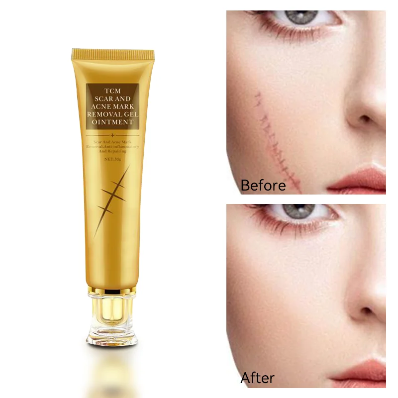 30g Remove Scars Cream Stretch Marks Fast Absorbed Quickly Pigmentation Corrector Korean Skin Care Product
30g Remove Scars Cream Stretch Marks Fast Absorbed Quickly Pigmentation Corrector Korean Skin Care Product