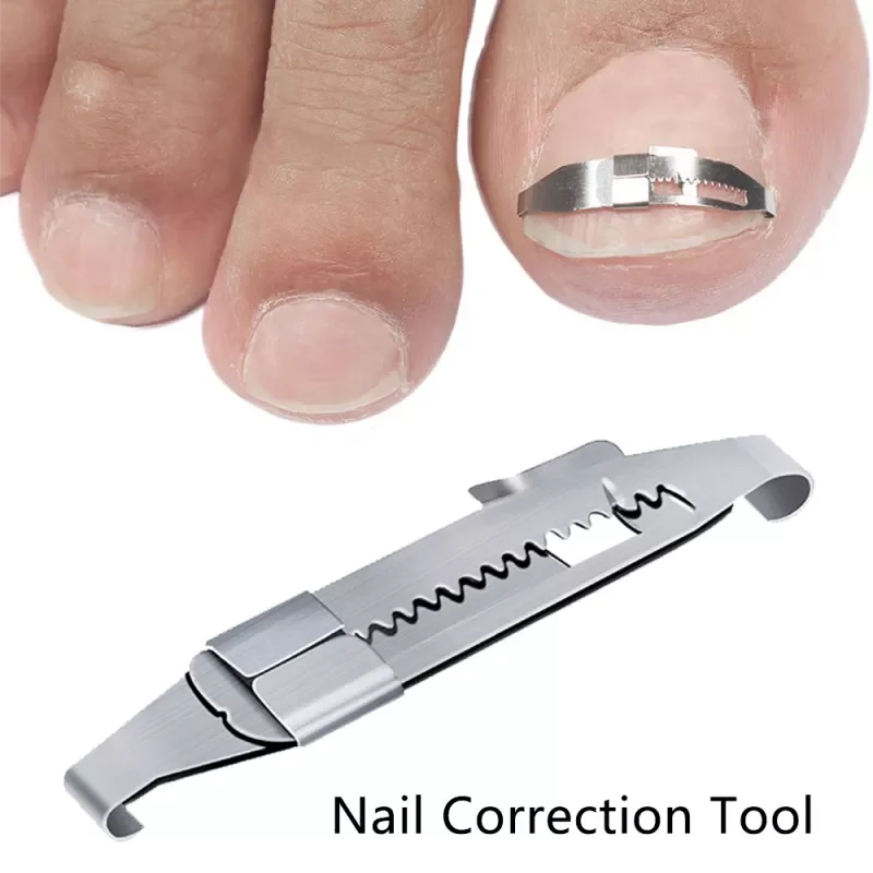 Toe Nail Correction Tool Toenail Straightening Correctors Patch Tool Straightening Clip Brace Pedicure Tool
Toe Nail Correction Tool Toenail Straightening Correctors Patch Tool Straightening Clip Brace Pedicure Tool