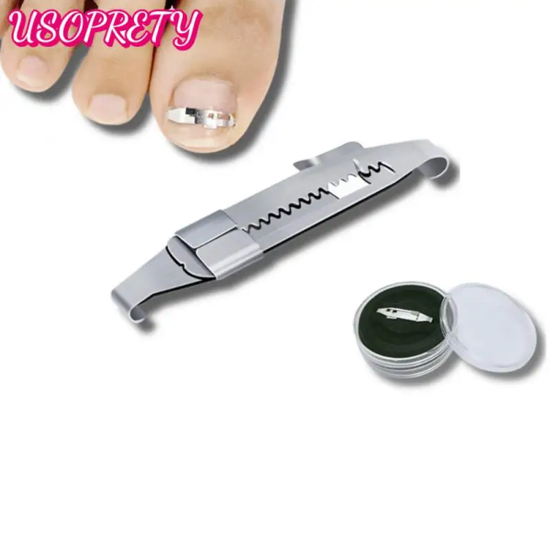 Ingrown Toenail Pedicure Foot Tool Nail Bunion Corrector Embed Paronychia Pedicure Positive Nail Buckle Positive Nail Sticker
Ingrown Toenail Pedicure Foot Tool Nail Bunion Corrector Embed Paronychia Pedicure Positive Nail Buckle Positive Nail Sticker