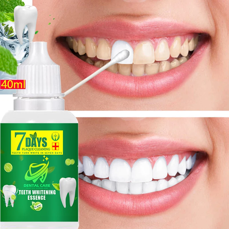 Liquid tooth whitening essence removes plaque pigment, halitosis, coffee tea, cleaning teeth, nursing refreshing breath products
Liquid tooth whitening essence removes plaque pigment, halitosis, coffee tea, cleaning teeth, nursing refreshing breath products