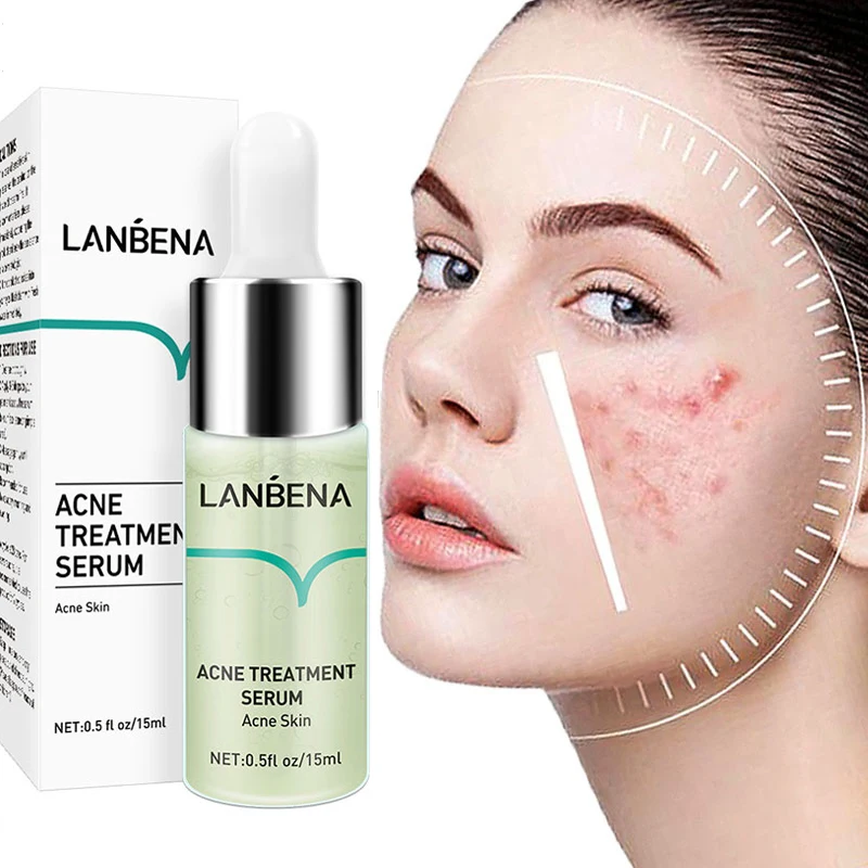 Acne Removal Face Serum Salicylic Acid Acne Treatment Repair Fade Scar Oil Control Moisturizing Brighten Skin Care Products
Acne Removal Face Serum Salicylic Acid Acne Treatment Repair Fade Scar Oil Control Moisturizing Brighten Skin Care Products