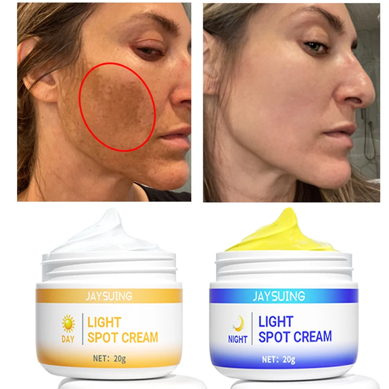 2PCS Day Night Freckles Cream Remover Dark Spot Melasma Whitening Face Care Fade Acne Scars Pigmentation Moisturizing Cosmetics
2PCS Day Night Freckles Cream Remover Dark Spot Melasma Whitening Face Care Fade Acne Scars Pigmentation Moisturizing Cosmetics