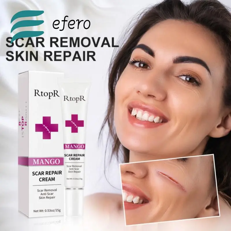 Repair Cream Fade Scars Stretch Marks Cream Acne Spots Treatment Blackheads Scars Skin Repair Cream Korean Cosmetics Skin Care
Repair Cream Fade Scars Stretch Marks Cream Acne Spots Treatment Blackheads Scars Skin Repair Cream Korean Cosmetics Skin Care