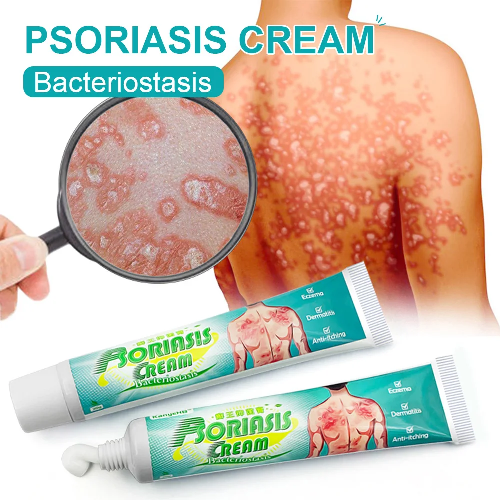 20g Psoriasis Cream Itch Relief Eczema Dermatitis Psoriasis Treatment Ointment Fungus Inhibition Cream For Hands Foot Skin
20g Psoriasis Cream Itch Relief Eczema Dermatitis Psoriasis Treatment Ointment Fungus Inhibition Cream For Hands Foot Skin