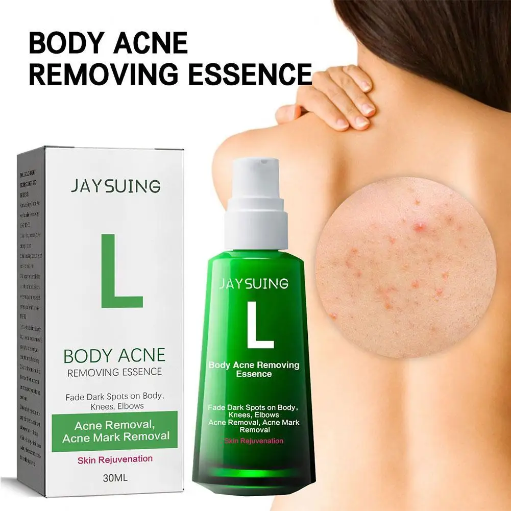 Body Acne Remover Serum For Acne Treatment Pimple Remover Shrink Pores Oil Control Suitable For All Skin Care
Body Acne Remover Serum For Acne Treatment Pimple Remover Shrink Pores Oil Control Suitable For All Skin Care