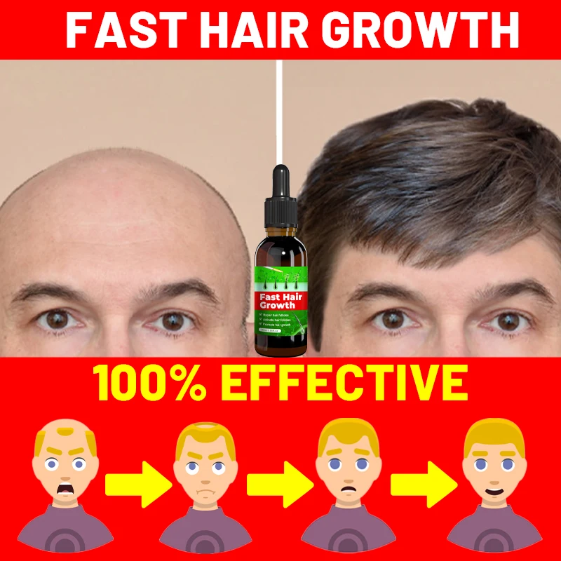 

Быстрое масло для роста волос, эффективное масло для роста волос, восстановление облысения, выпадение волос со временем после родов, против выпадения волос