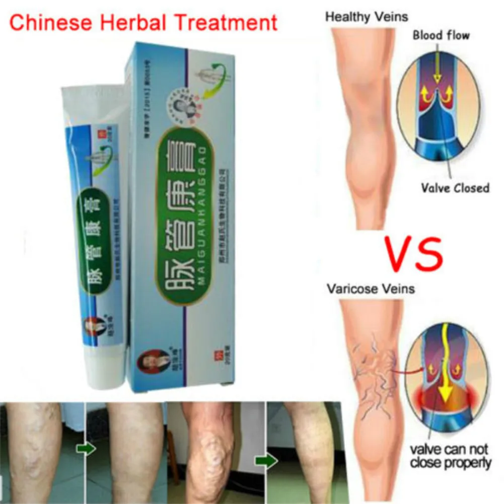 20g Varicose Veins Ointment Varicose Cream Herbal Treatment Ointment Vein Inflammation Varicose Veins Foot Legs Skin Care Cream
20g Varicose Veins Ointment Varicose Cream Herbal Treatment Ointment Vein Inflammation Varicose Veins Foot Legs Skin Care Cream