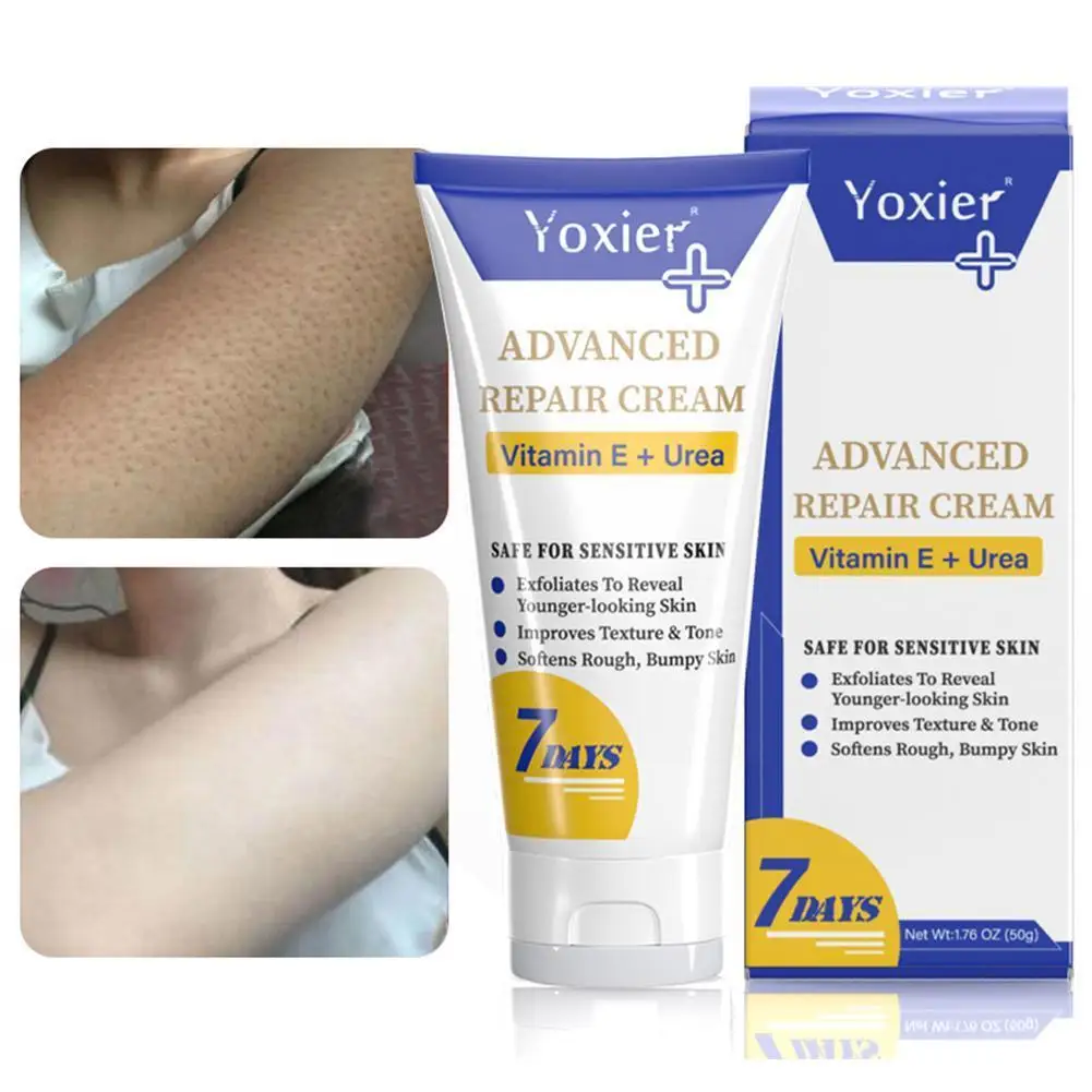 Moisturizing Body Cream Treatment Keratosis Pilaris Skin Bumpy Vitamin Skin Cream Rough E Health Care Softens Products Whit T6K0
Moisturizing Body Cream Treatment Keratosis Pilaris Skin Bumpy Vitamin Skin Cream Rough E Health Care Softens Products Whit T6K0