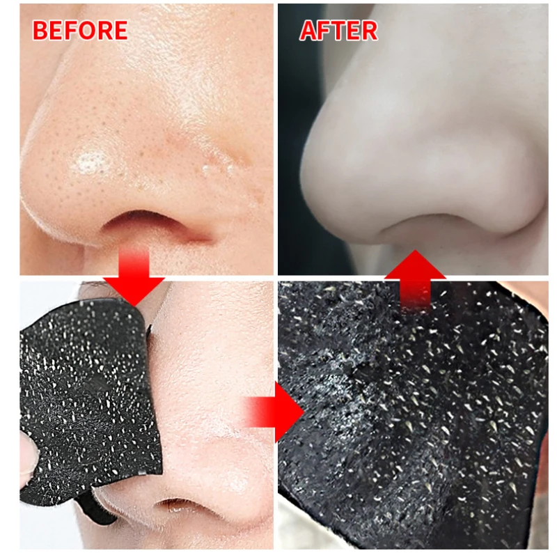 

10PCS Blackhead Remover Mask Deep Cleansing Shrink Pore Acne Treatment Peel Off Mask Skin Care Nose Black Dots Pore Strips