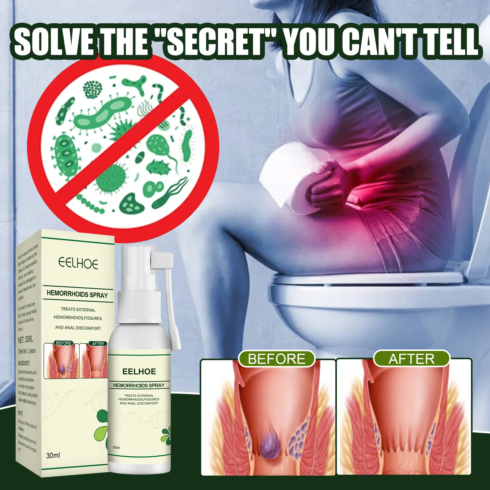 Remove Hemorrhoids Ointment Eliminate Haemorrhoid Remove Hemorrhoids Care Relieve Itching Relieve Swelling Hemorrhoids Spray
Remove Hemorrhoids Ointment Eliminate Haemorrhoid Remove Hemorrhoids Care Relieve Itching Relieve Swelling Hemorrhoids Spray