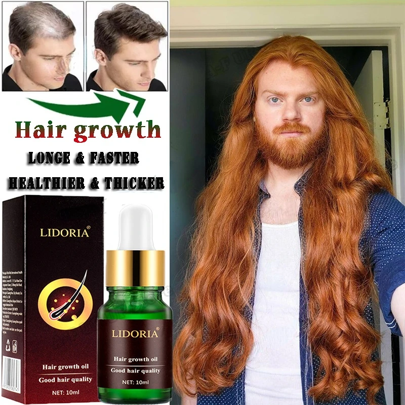 Hair Growth Products Fast Hair Grow Serum Prevent Hair Loss Promote Hair Growth For Men Women Restore Thick Longer Hair Tonic
Hair Growth Products Fast Hair Grow Serum Prevent Hair Loss Promote Hair Growth For Men Women Restore Thick Longer Hair Tonic