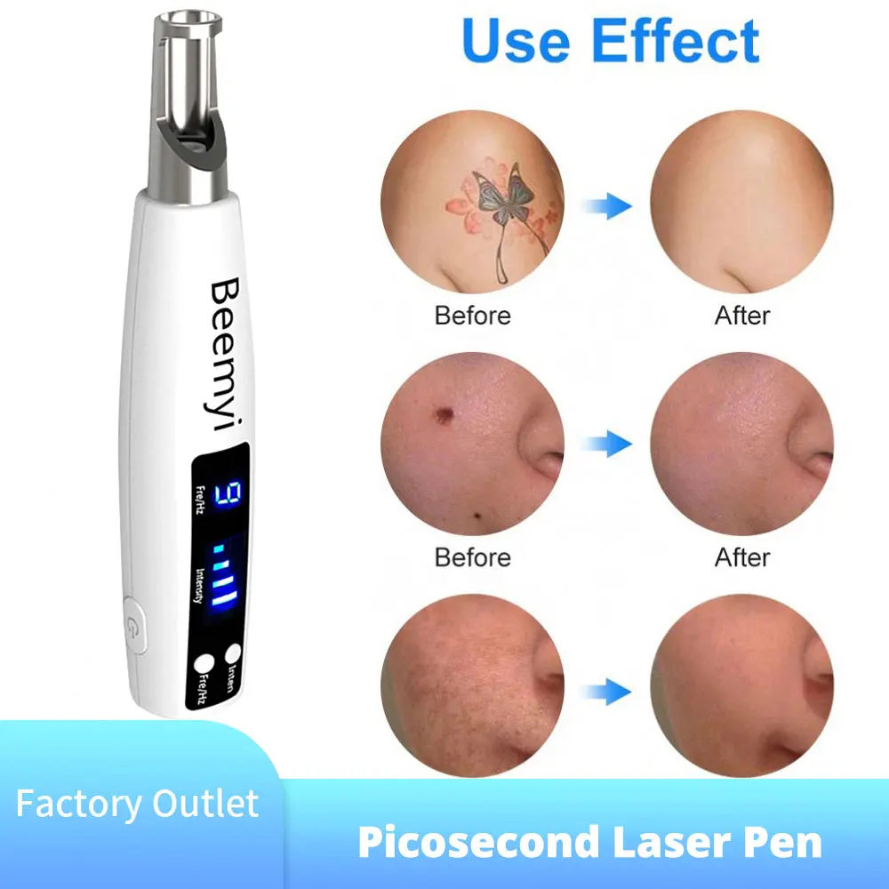 

Beemyi Laser Picosecond Pen Red Blue Light Therapy Tattoo Remove Freckle Acne Mole Dark Spot Pigment Removal Machine Skin Care