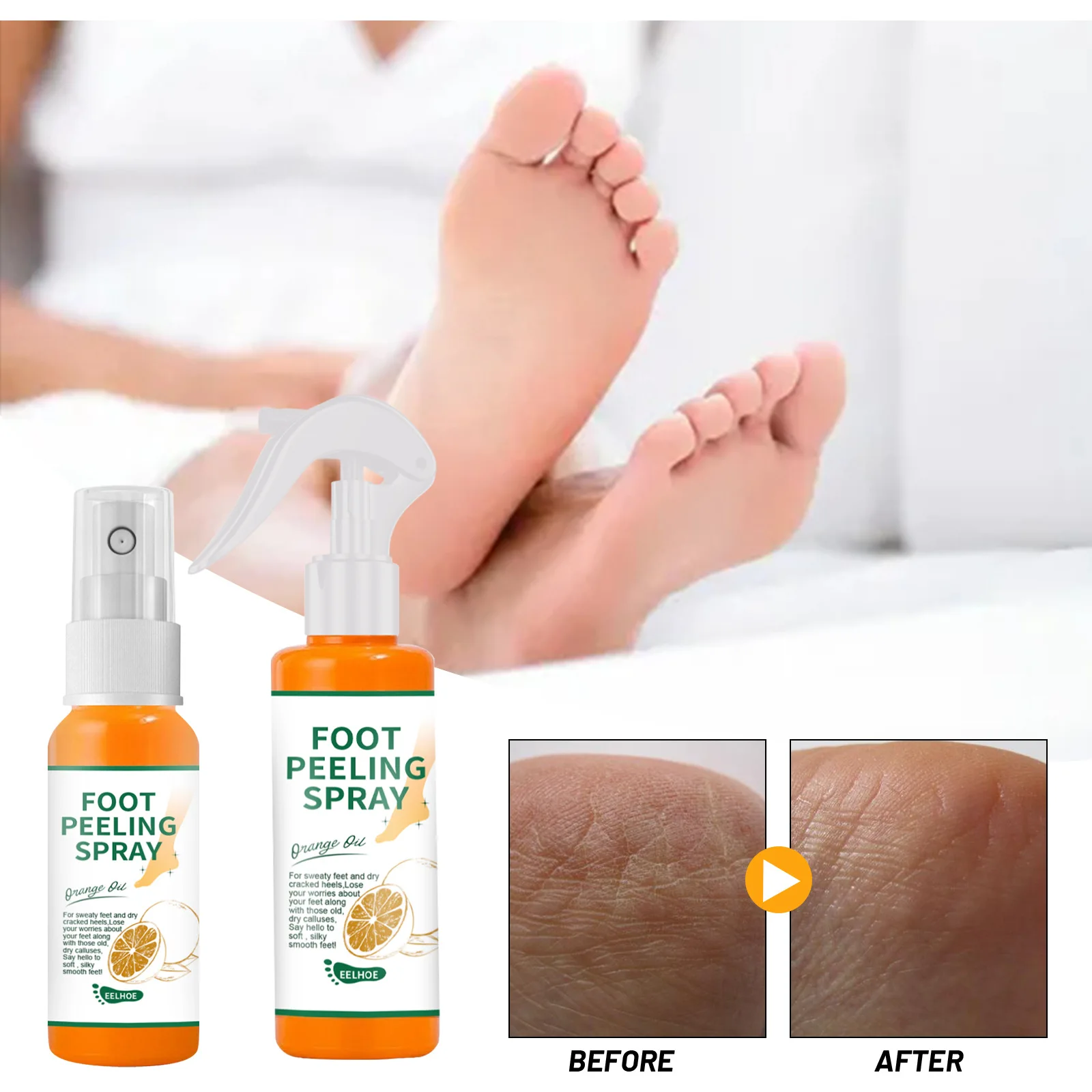 Foot Care Spray Exfoliating Improve Foot Dry Cracked Nourishing Moisturizing Repair Damaged Skin Peeling Treatment Whitening
Foot Care Spray Exfoliating Improve Foot Dry Cracked Nourishing Moisturizing Repair Damaged Skin Peeling Treatment Whitening