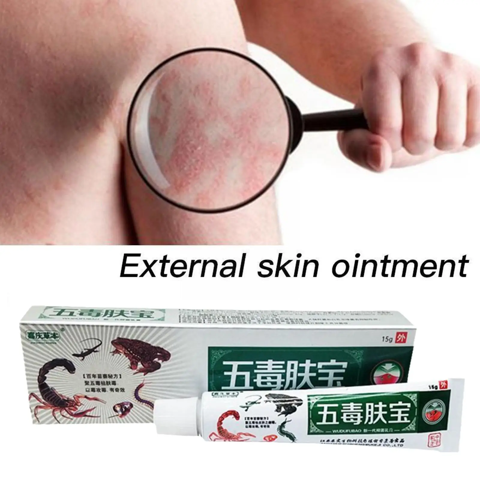 Effective Relief Skin Psoriasis Cream For Skin Problems’ Chinese Herbal Antibacterial Ointment Treatment Of Skin Moss T0n4
Effective Relief Skin Psoriasis Cream For Skin Problems’ Chinese Herbal Antibacterial Ointment Treatment Of Skin Moss T0n4