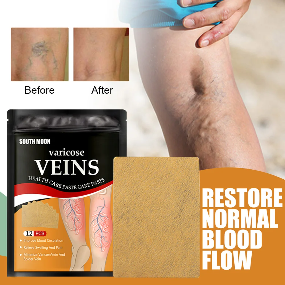12/24/36Pcs Varicose Vein Treatment Patch Leg Sore Swelling Relief Plaster Patch Earthworm Leg Health Care Sticke Removal Pain
12/24/36Pcs Varicose Vein Treatment Patch Leg Sore Swelling Relief Plaster Patch Earthworm Leg Health Care Sticke Removal Pain
