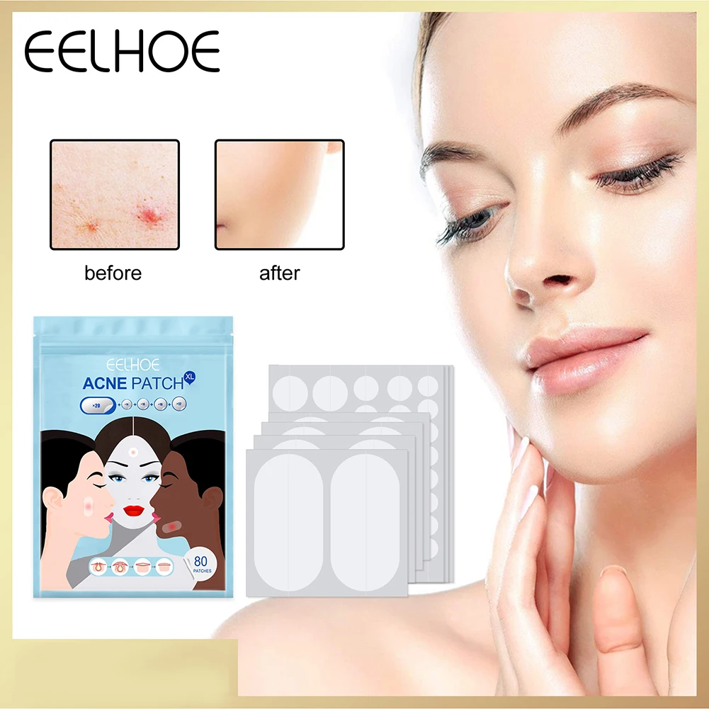 80pcs 8/10/12mm Acne Patches Pimple Healing Treatment Invisible Spot Stickers Skin Tag Remover Facial Care Beauty Tools
80pcs 8/10/12mm Acne Patches Pimple Healing Treatment Invisible Spot Stickers Skin Tag Remover Facial Care Beauty Tools
